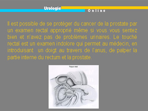 90220_le_touche_rectal.jpg