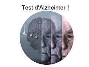 Alzheimer.jpg